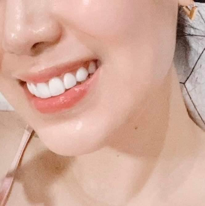 Fairy Skin - Premium Brightening Kit