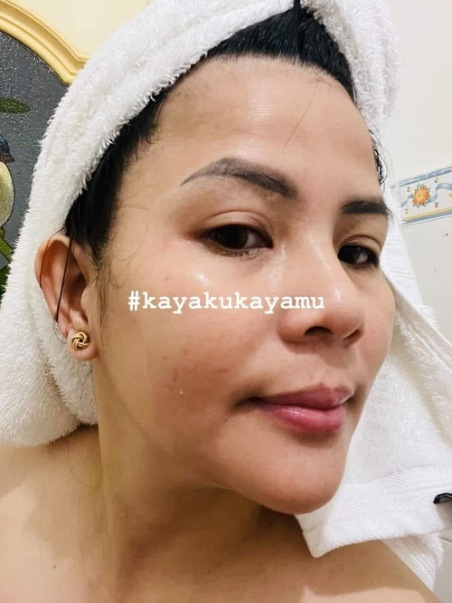 Brilliant Skin - Kayakukayamu Soap 70g