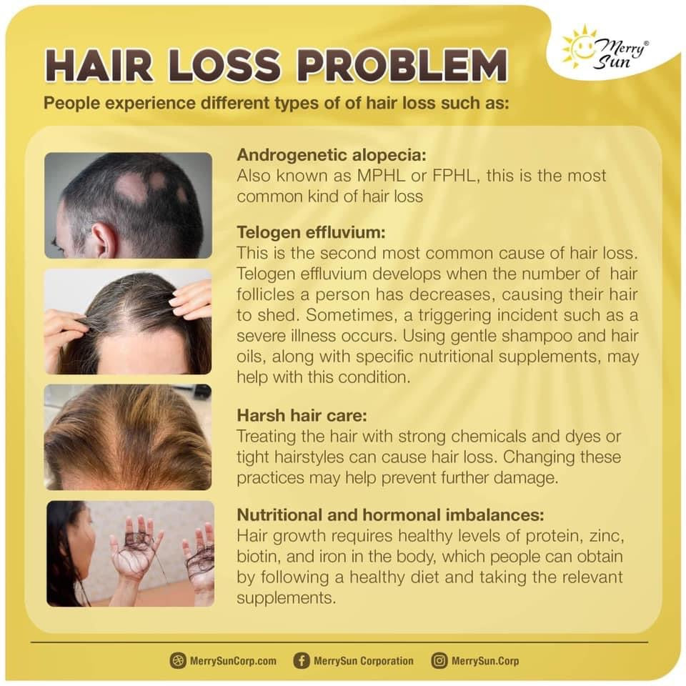 Merry Sun - Ginger Hair Tonic Natural Grower Spray 30ml